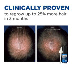 Buy Men's Rogaine Extra Strength 5% Minoxidil Topical Solution for Hair Loss and Hair Regrowth Online in UAE