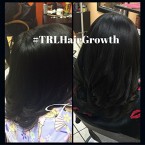 Buy High Quality Trl Faster Hair Growth Oil For Sale In UAE