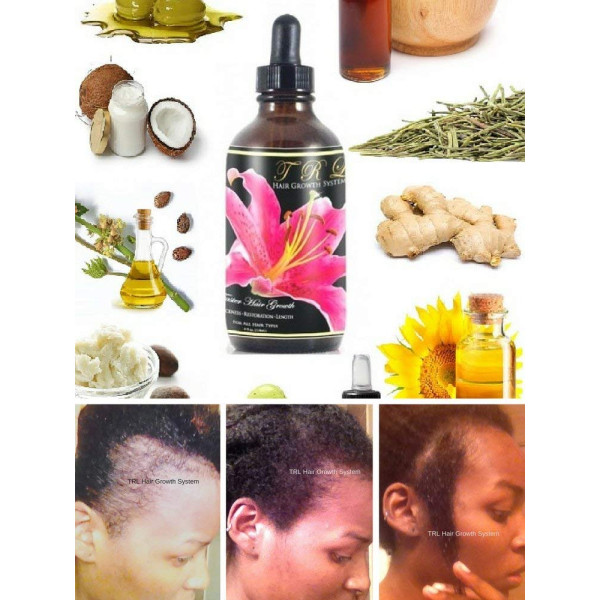 Buy High Quality Trl Faster Hair Growth Oil For ..