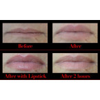 Buy online best Lip  plumpers with special Gifts in UAE 