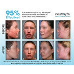 Buy Neutralyze Moderate To Severe Acne Clearing Serum & Synergyzer Online in UAE