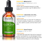 Buy Skin Serum Age-Defying formula for acne-prone skin Vitamin C, Retinol, Niacinamide, Salicylic Acid imported from USA