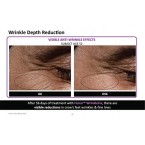 Buy Retinol + Complete Anti-Aging Facial Moisturizer Cream with Hyaluronic Acid Online in UAE