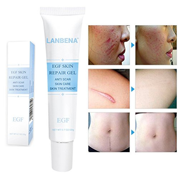 Buy Egf Repair Gel Scar Remover Cream - Repair F..