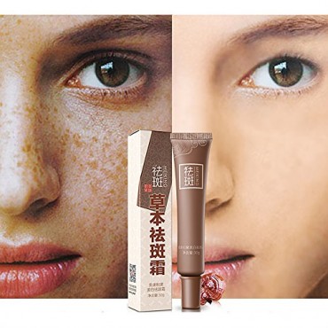 skin whitening cream dark spot corrector skin lightening & whitening age spot shop online in UAE