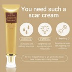 Best Acne Scar Removal Cream - Acne Spots Treatment & Stretch Marks Relief Buy in UAE