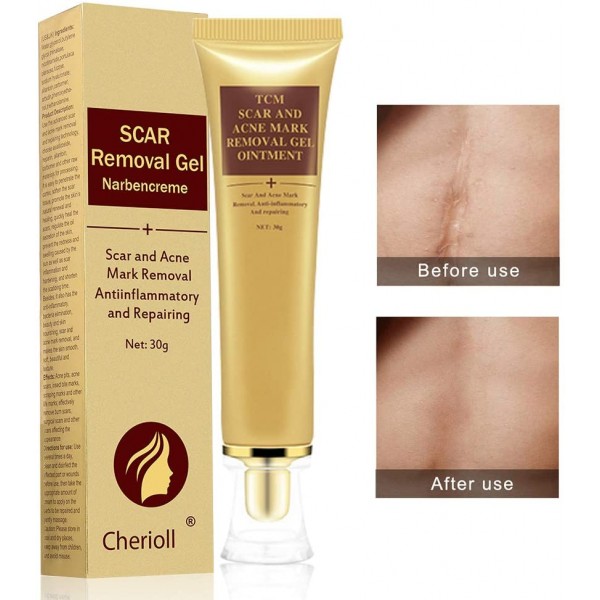Best Acne Scar Removal Cream - Acne Spots Treatment & Stretch Marks Relief Buy in Pakistan