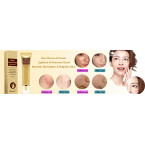 Scar Cream, Acne Scar Removal Cream,Acne Spots Treatment,Stretch Marks Relief and Burns Repair,Face Skin Repair Cream 30ml