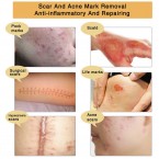 TCM Scar and Acne Mark Removal Gel, Stretch Marks, Skin Repair, Blackhead Whitening Cream in UAE