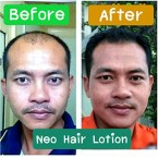 Imported Neo Hair Lotion Herbs 100% Natural STOP Hair Loss Root Nutrients Made in Thailand for sale in UAE