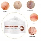 Imported Scar Removal Cream | Lightens Old & New Scars Shop in UAE