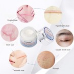 Buy Face Skin Repair Cream | Acne Scars & Stretch Marks Removal Cream in UAE