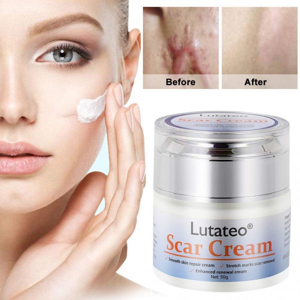 Buy Face Skin Repair Cream | Acne Scars & Stretch Marks Removal Cream in Pakistan