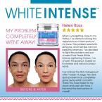 White intense Lightening Cream For Dark Spots, Scars, Sensitive & Intimate Areas in UAE