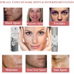 Effective Skin Brightening Cream & Dark Spot Remover for Face, Armpit & Intimate Parts Buy in UAE