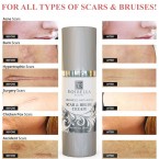 Voibella Beauty Scar Removal Cream | Best Cream for Old or New Acne & Stretch Marks Buy in UAE