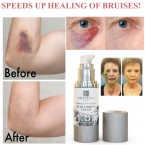 Voibella Beauty Scar Removal Cream | Best Cream for Old or New Acne & Stretch Marks Buy in UAE