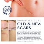 Buy Advance Silicone Scar Gel Scar Remover Gel for Scars from C-Section, Stretch Marks, Acne, Surgery in UAE