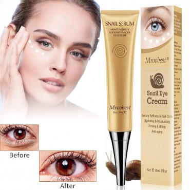 Perfect Anti Aging Eye Cream for Dark Circles, Puffiness & Under Eye Bags Buy in Pakistan