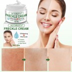 Freckle Cream by SCOBUTY - Removes Freckle & Dark Spots Shop in UAE