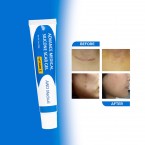Silicone Gel for Scar Removal with Vitamin E Oil | Best for Acne Scars Buy in UAE