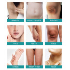 Intimate Skin Whitening Cream For Knees, Lightening Cream for Armpits, Body, Neck, Elbows, Sensitive & Private Areas, Whitens, Nourishes, Brightens & Restores Underarm Skin