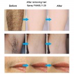 Hair Removal Inhibitor Oil Permanent Depilatory Armpit Beard Legs Pubic Bikini Hair For Body Face Hair Removal Cream for Women Girls(Hair Removal Inhibitor)