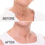 Buy Advanced Clinicals Rapid Neck Lift Tightening Cream Online in UAE