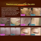 Buy Wisdompark Acne Scar Removal Cream Online in UAE