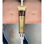 Buy Wisdompark Acne Scar Removal Cream Online in UAE