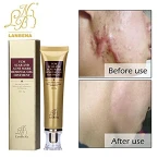 Buy Wisdompark Acne Scar Removal Cream Online in UAE