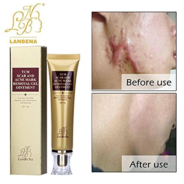 Buy Wisdompark Acne Scar Removal Cream Online in UAE