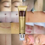 Buy Wisdompark Acne Scar Removal Cream Online in UAE