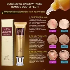 Buy Wisdompark Acne Scar Removal Cream Online in UAE