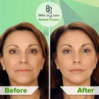 Buy Retinol Moisturizer Anti Aging Cream for Face and Eye Area Online in UAE