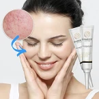 Buy Acne Erasing Emulsion by Evanesce New York Online in UAE