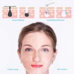 Abody Blackhead Remover Vacuum, Electric Skin Facial Pore Cleaner Blackhead Vacuum Suction Removal Blackhead Extractor with LED Display and 4 Suction Heads for Women Men Face Nose