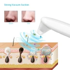 Abody Blackhead Remover Vacuum, Electric Skin Facial Pore Cleaner Blackhead Vacuum Suction Removal Blackhead Extractor with LED Display and 4 Suction Heads for Women Men Face Nose