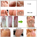 Get online Best Quality Foot Peel Mask in UAE 
